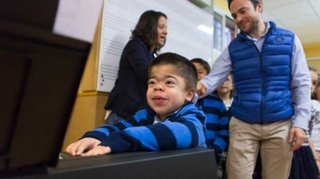 Ni&ntilde;o afectado por el s&iacute;ndrome de Hunter