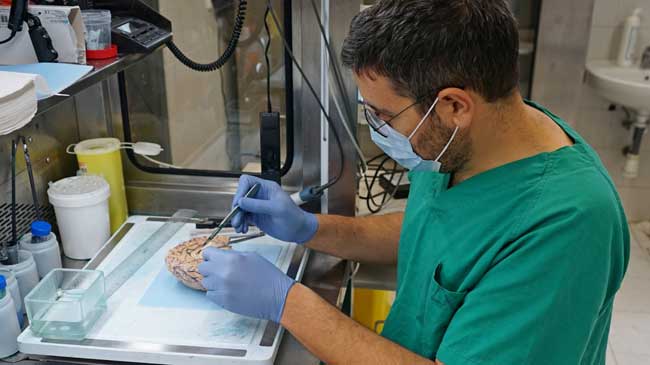 El Banco de Cerebros de la Arrixaca realiza el proceso de estudio molecular y diagn&oacute;stico